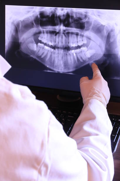 Best Emergency Wisdom Teeth Removal in Gloster, MS